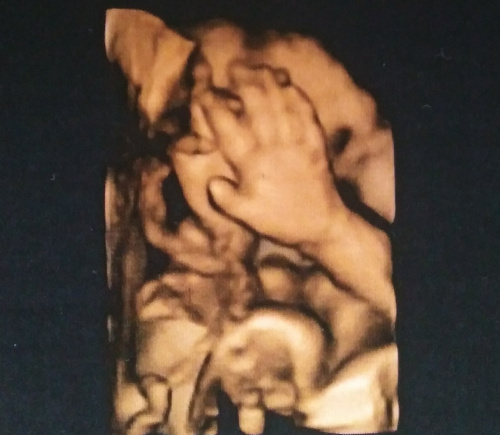 ebacc2be50462845med.jpg